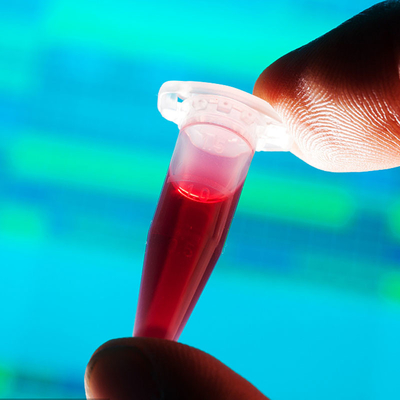 Tiers service d'authentification de laboratoires d'essais de détection de nourriture de biberon rapide approuvé par le FDA de contact
